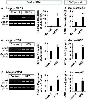 Corrigendum: Role of Hippocampal Lipocalin-2 in Experimental Diabetic Encephalopathy